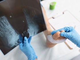 복지부 “예방 가능한 외상 사망률 꾸준한 감소 추세”