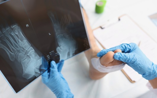 복지부 “예방 가능한 외상 사망률 꾸준한 감소 추세”