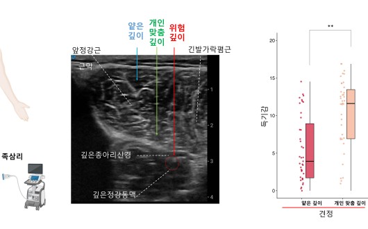 “개인 맞춤 침 자입 깊이가 득기·안전성 모두 높인다”