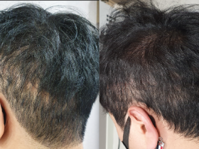 한의사 9명…"최근 20년간의 문신 관련 의학 연구 동향 분석”