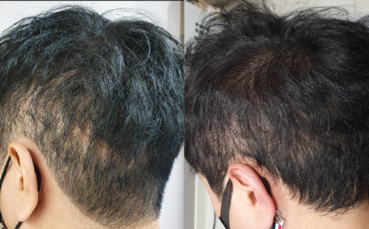 한의사 9명…"최근 20년간의 문신 관련 의학 연구 동향 분석”