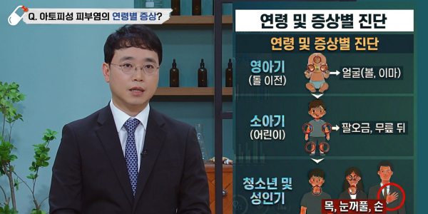 대구한의대한방병원 황보민 교수, ‘아토피 피부염’ 한의학적 치료 안내
