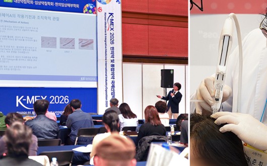 “탈모치료 시장, 약침의 ‘염증·혈류·자음’ 3축으로 패러다임 전환”