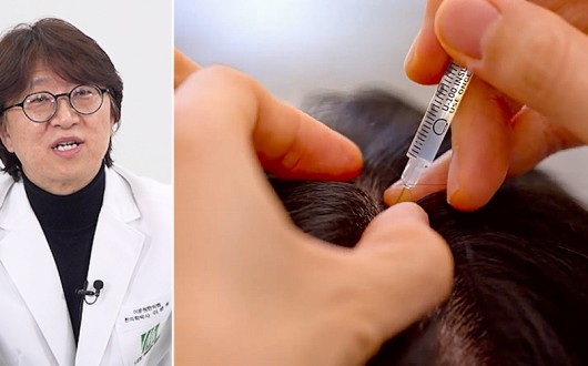 탈모 치료, 약침의 ‘소염·자음·보혈’ 3축 관리법으로 패러다임 전환