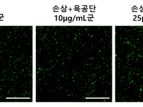 육공단의 해마 신경세포 보호효과 및 작용기전 규명