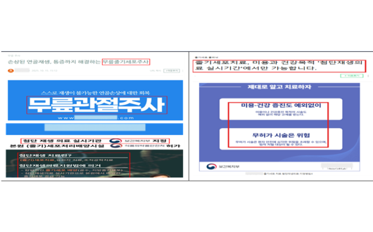 보건복지부, 재생의료 거짓 과대광고 246건 적발