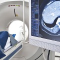 병원 옮기면 또 찍는 CT·MRI 비용, 연간 650억원…건보 재정 ‘줄줄’