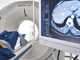 병원 옮기면 또 찍는 CT·MRI 비용, 연간 650억원…건보 재정 ‘줄줄’