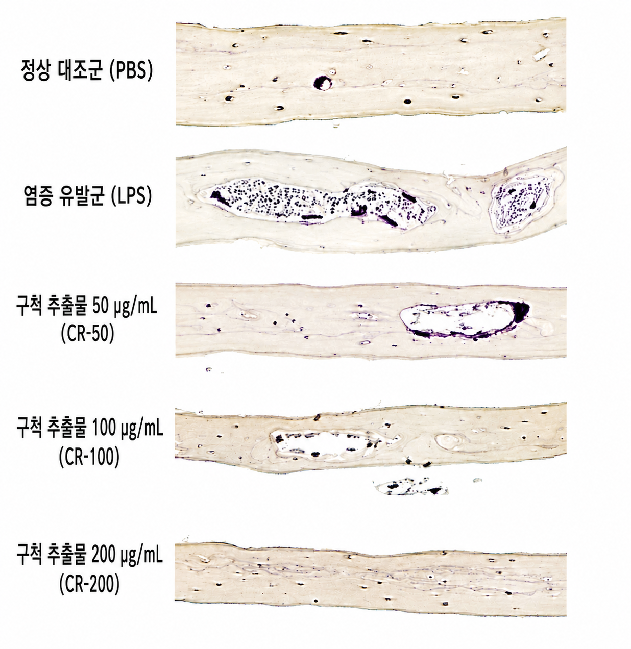 한약재 ‘구척’의 염증성 골소실 억제효과 및 치료기전 규명