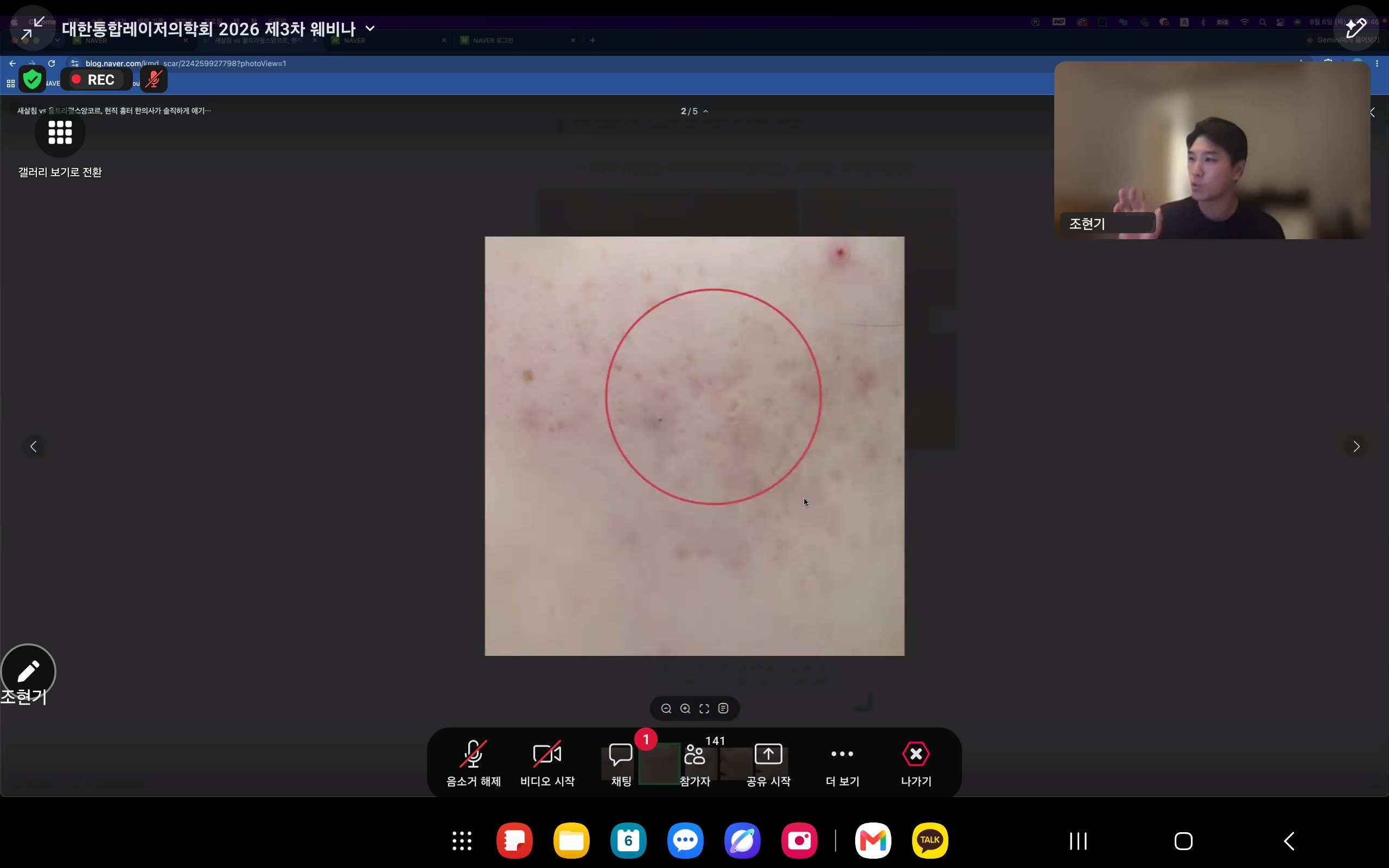 “새살침·도침 등 한의 술기에 레이저·스킨부스터 더한다”