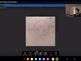 “새살침·도침 등 한의 술기에 레이저·스킨부스터 더한다”