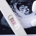 정부, 임신중지 약물 정식 도입…첫 2년간 의료기관 직접 처방·조제