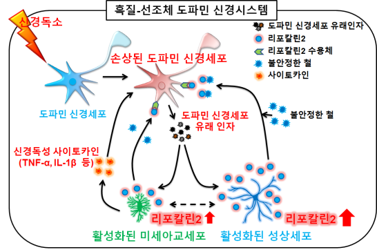 파킨슨 질환의 새로운 내인성 염증 병인체 발견 > 뉴스 | 한의신문