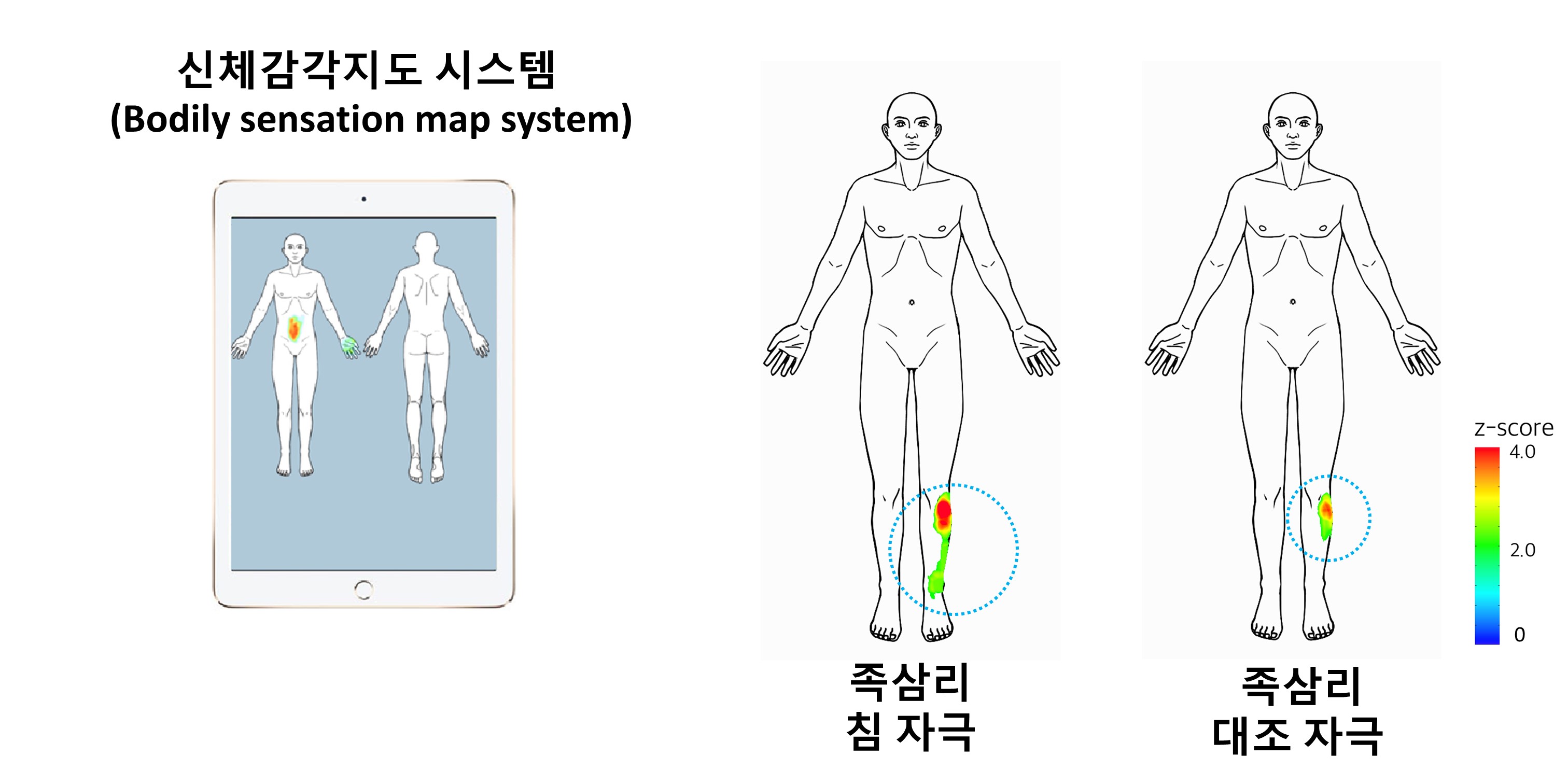 [임상정보]침 자극은 자극 부위 외에 다른 신체부위에도 감각의 변화 유발 > 뉴스 | 한의신문