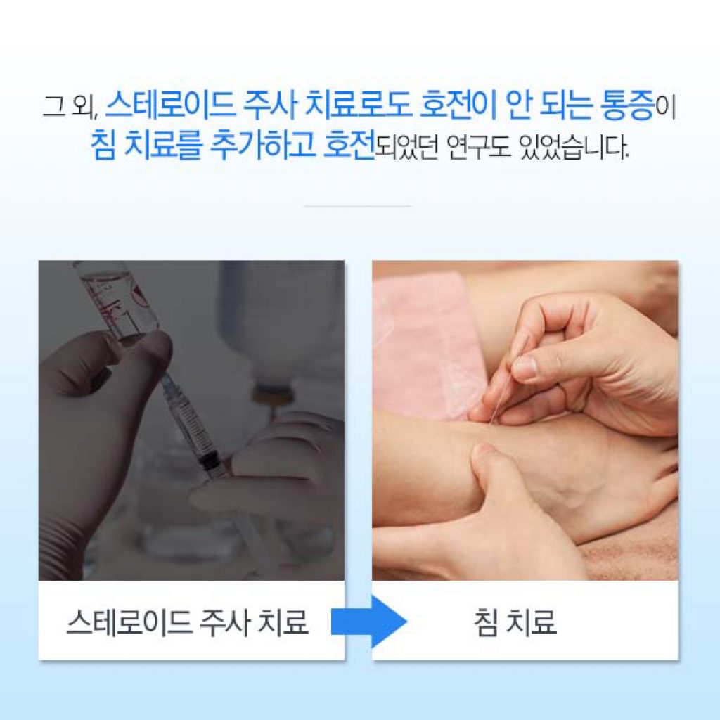 족저근막염-10 복사