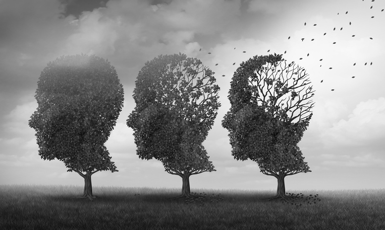 Concept of memory loss and brain aging due to dementia and alzheimer
