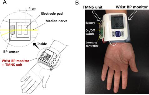 혈압을 낮추는 고혈압 치료장치. 특허 제 1013496800000